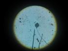 Siva Plijesan S Kruha Pod Mikroskopom Uveana 100X...Vide Se Sporangiofor, Sporangiji I Razasute Spore